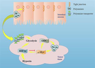 Effects of glycolysis and polyamine predation on intestinal epithelial barrier in colorectal cancer